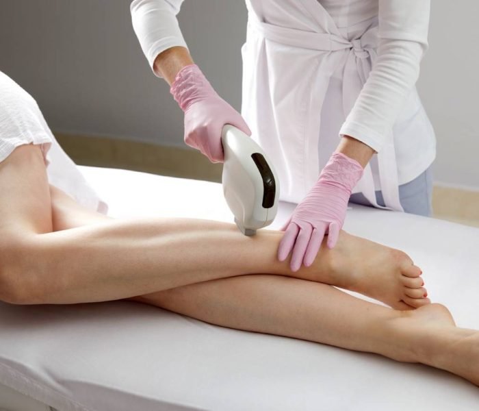 Aesthetician performing laser hair removal on a woman's legs for smooth skin.
