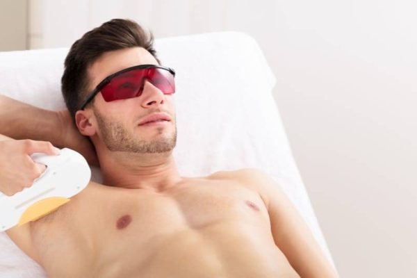 Man undergoing laser hair removal treatment on his underarm, wearing protective eyewear.