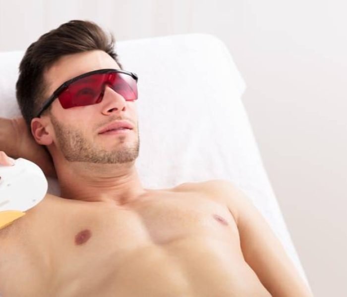 Man undergoing laser hair removal treatment on his underarm, wearing protective eyewear.